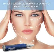 Microneedling