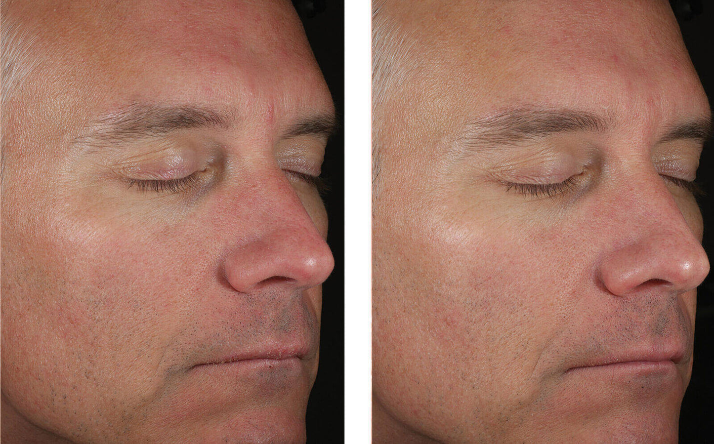 Solo Hydrating Defense Men Skin Better