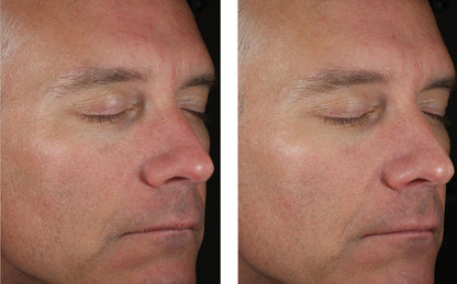 Solo Hydrating Defense Men Skin Better